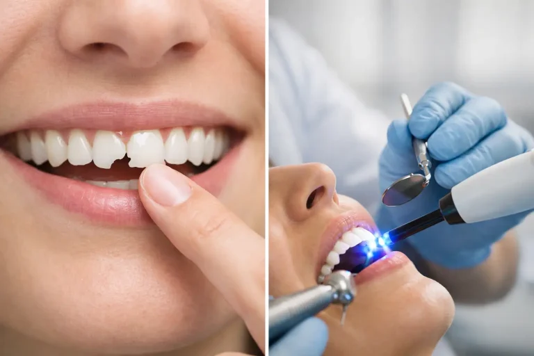 Read more about the article How to Fix Chipped Tooth Safely and Protect Your Smile